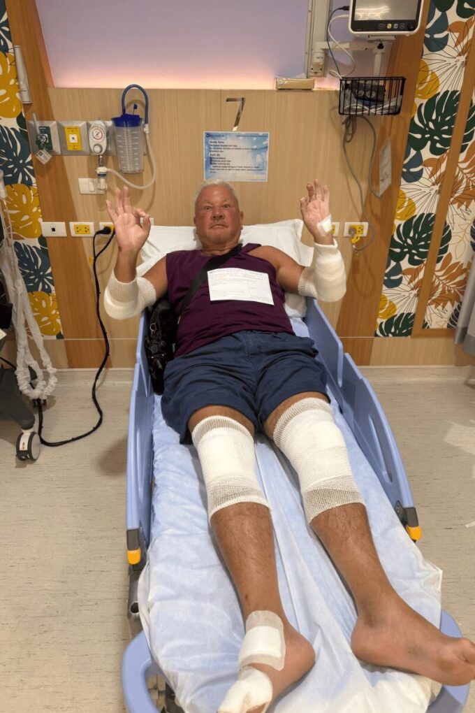 A badly injured ankle