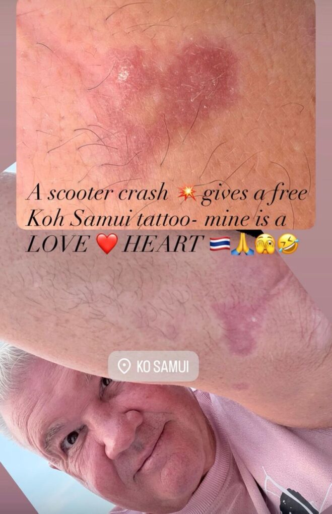 A Heart-Shaped Scar